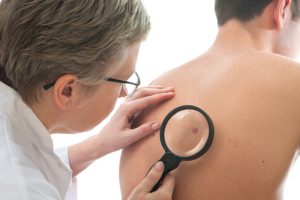 Dermatologist examines a mole of male patient